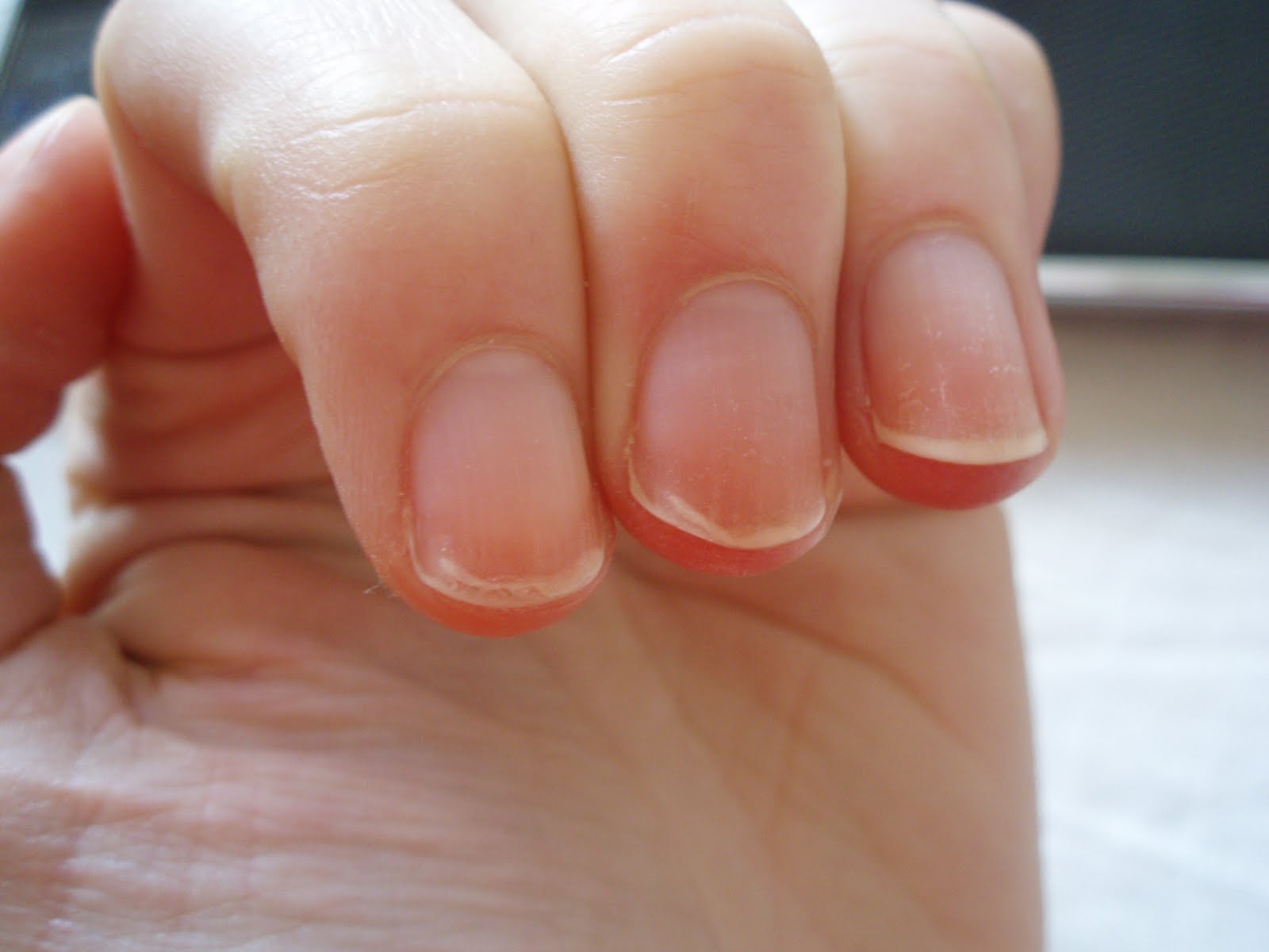 Блог :: Why nails exfoliate and how to cure them?