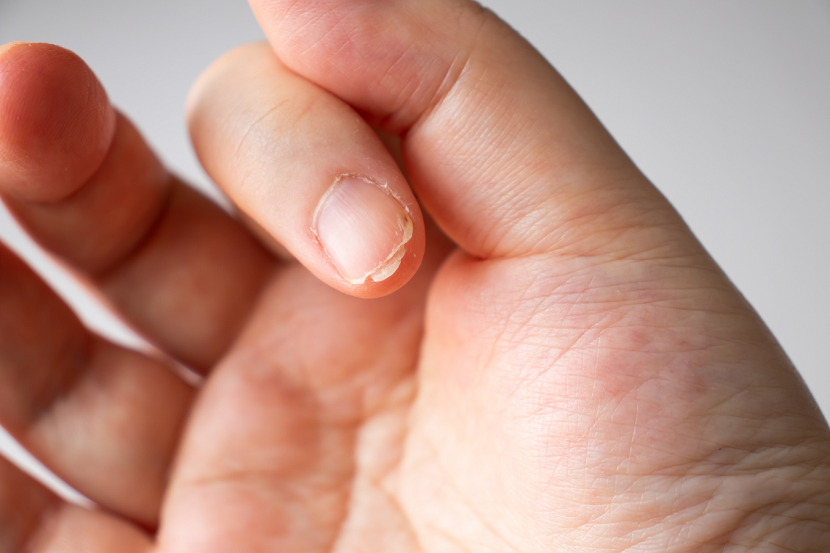 Dry hair, skin, and nails could point to underlying health problems | WRVO  Public Media